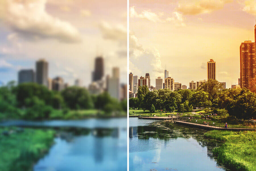 Cataract Surgery at Rosin Eyecare in Chicago