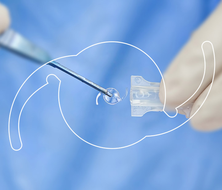 Cataract Surgery at Rosin Eyecare in Chicago, IL